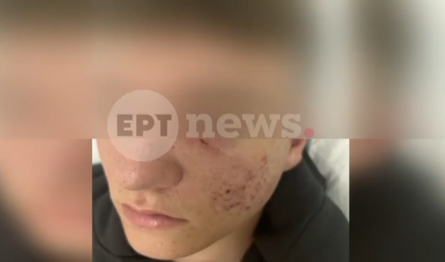Έστησαν παγίδα και ξυλοκόπησαν 15χρονο στην Ξάνθη - «Έφαγες ξύλο αγόρι μου;» του έστειλαν μήνυμα