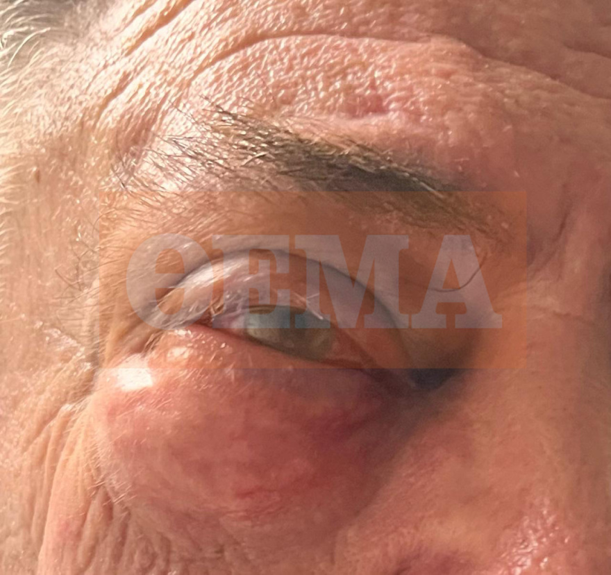 Συνελήφθη ο Ισραηλινός για τον ξυλοδαρμό του επιχειρηματία σε εστιατόριο της Γλυφάδας - Τι είπε στους αστυνομικούς