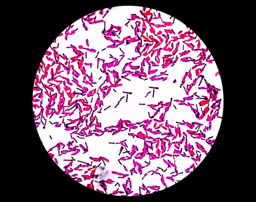 Υγειονομικός συναγερμός στην Ιταλία - Τρεις νεκροί από αλλαντίαση σε Καλαβρία και Σαρδηνία, κατανάλωσαν τρόφιμα από πλανόδιους