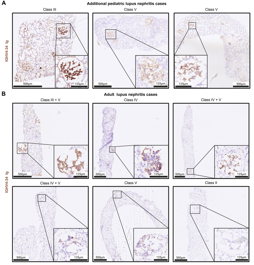 Διεθνής έρευνα με ελληνική συμμετοχή προτείνει καινοτόμα θεραπεία των αιματολογικών καρκίνων