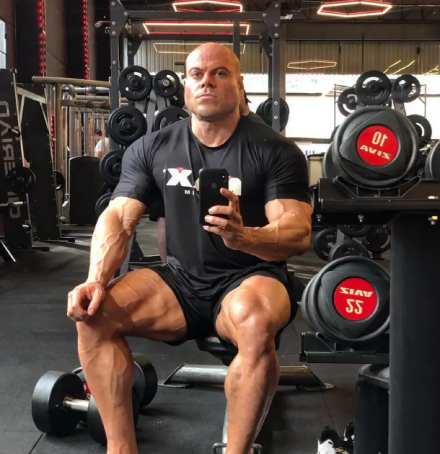43χρονη σκότωσε με 21 μαχαιριές τον bodybuilder σύζυγό της στη Βραζιλία - Είχε ανοίξει τρύπες στους τοίχους για να τον παρακολουθεί
