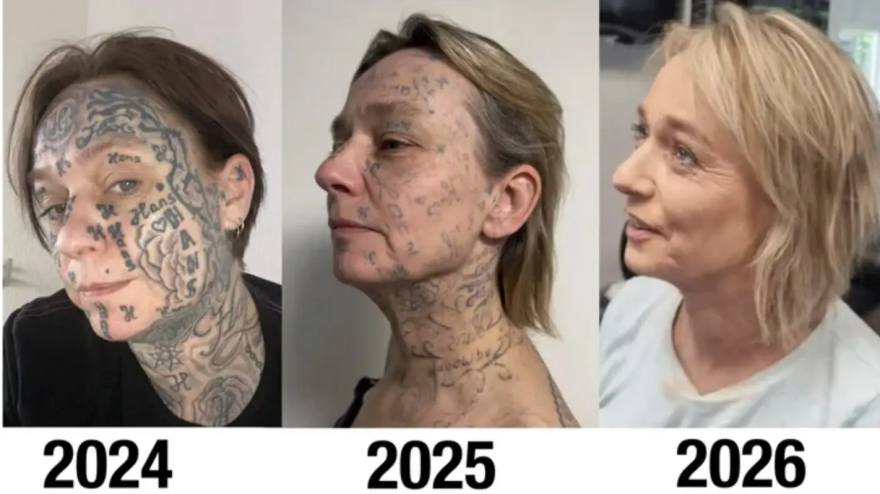 Απίστευτη κακοποίηση στην Ολλανδία: Έκανε τατουάζ 250 φορές το όνομά του στο κορμί της κοπέλας του!