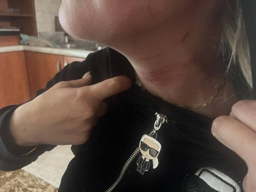 Κερατσίνι: «Με βίασε... γιατί έπιασα δουλειά» λέει η 45χρονη που κακοποίησε ο σύζυγός της