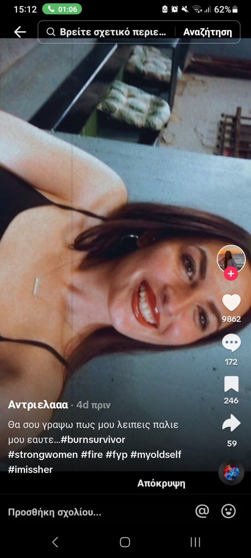 Πήλιο: Η περιπέτεια 22χρονης που κάηκε σε πρόσωπο και σώμα στην προσπάθεια να ανάψει σόμπα