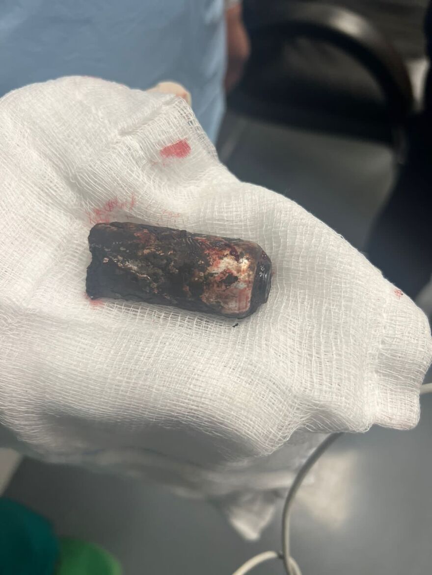 Οι δράστες των επεισοδίων στο Ρέντη προσπάθησαν να εξαφανίσουν τα ίχνη τους μέσα στο γήπεδο - Τι εξετάζουν οι αρχες