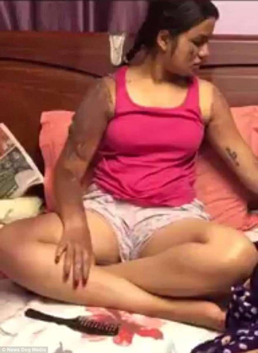 Βίντεο: «Λαμπάδιασε» κορίτσι όταν άναψε το κερί της τούρτας της δίπλα σε μπαλόνια