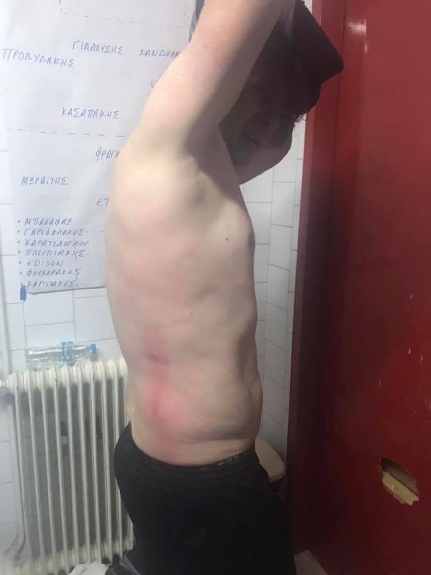 Βίντεο: Ξύλο στο Αστέρας Αμαλιάδας-Ηρόδοτος και διακοπή! 