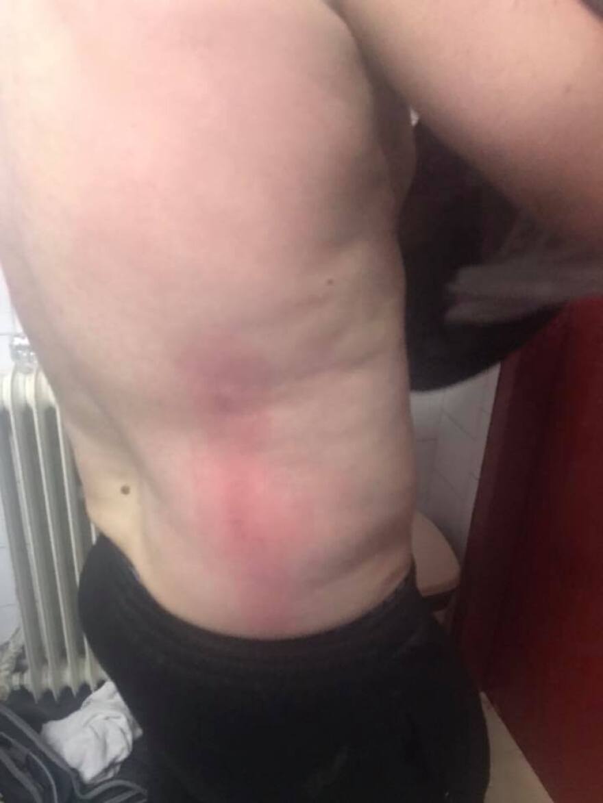 Βίντεο: Ξύλο στο Αστέρας Αμαλιάδας-Ηρόδοτος και διακοπή! 