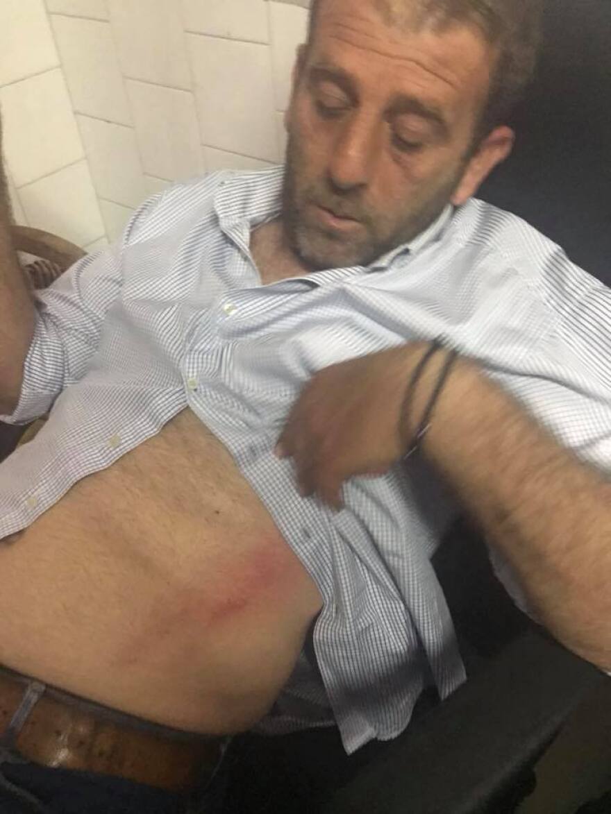 Βίντεο: Ξύλο στο Αστέρας Αμαλιάδας-Ηρόδοτος και διακοπή! 