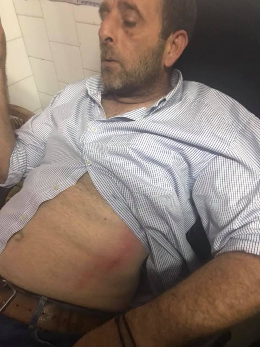 Βίντεο: Ξύλο στο Αστέρας Αμαλιάδας-Ηρόδοτος και διακοπή! 