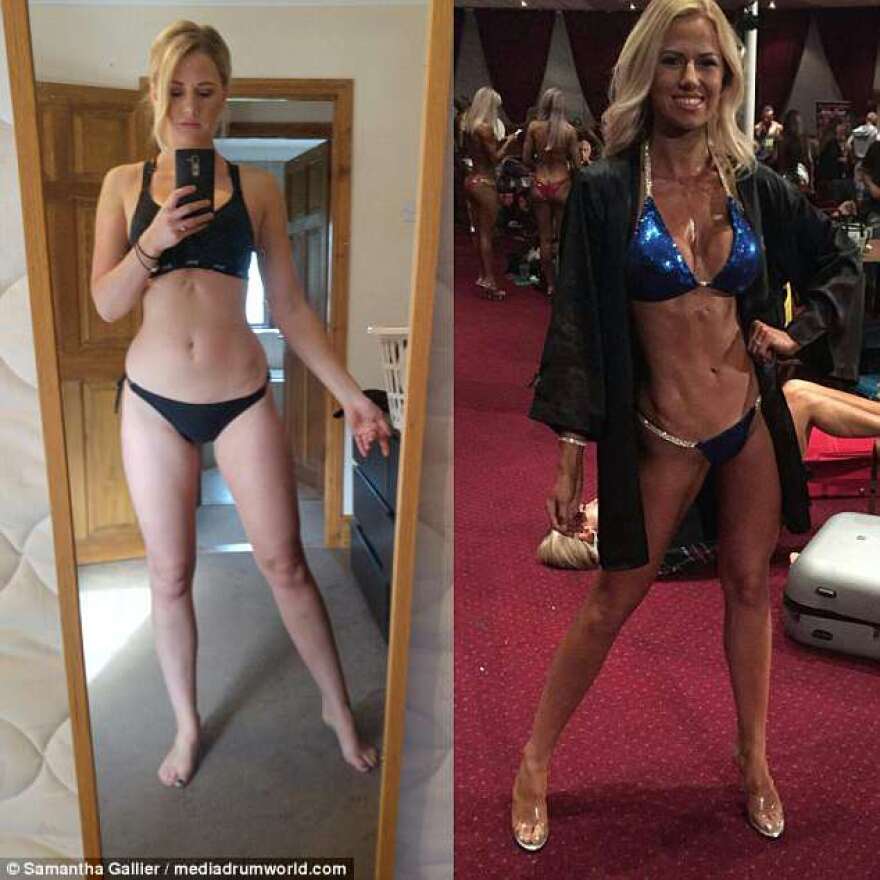 Samantha Gallier... γεννήθηκε με τρεις τρύπες στην καρδιά, «πέθανε» δύο φορές και έγινε bodybuilder