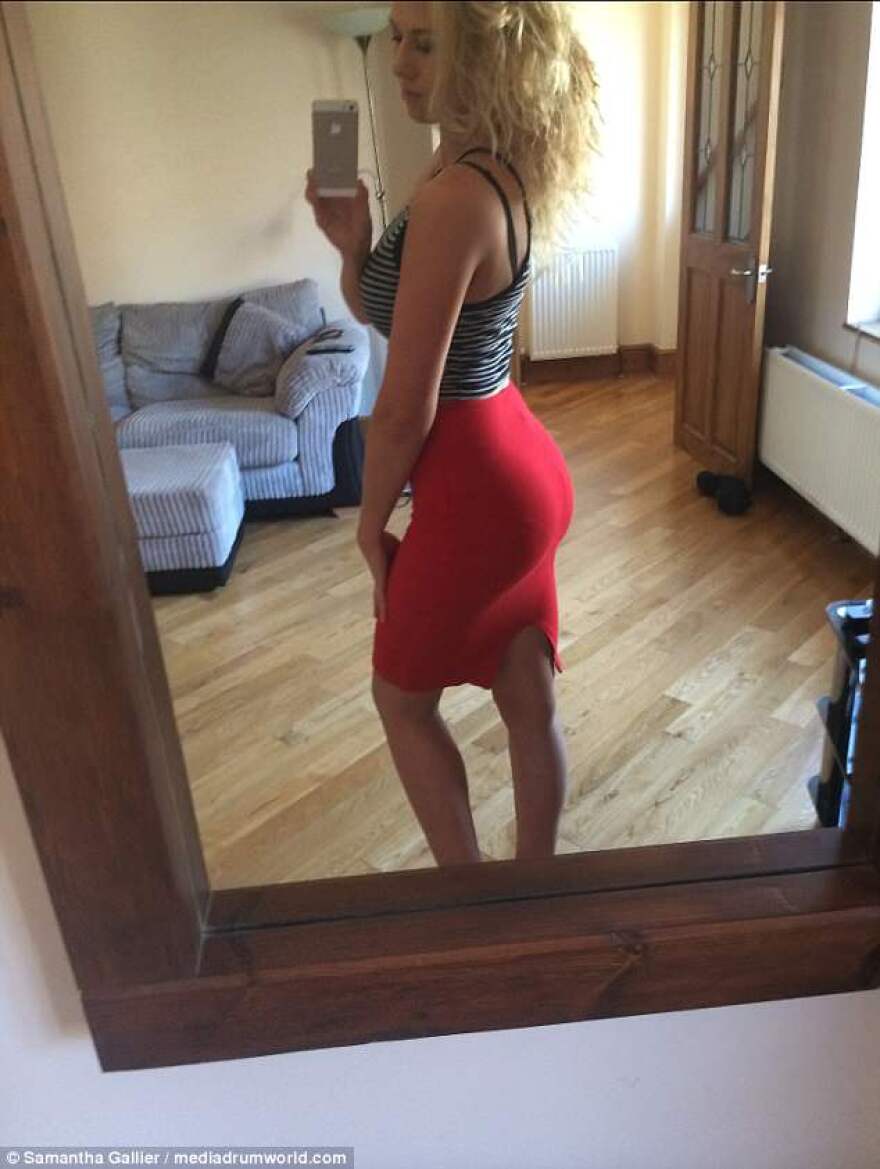 Samantha Gallier... γεννήθηκε με τρεις τρύπες στην καρδιά, «πέθανε» δύο φορές και έγινε bodybuilder