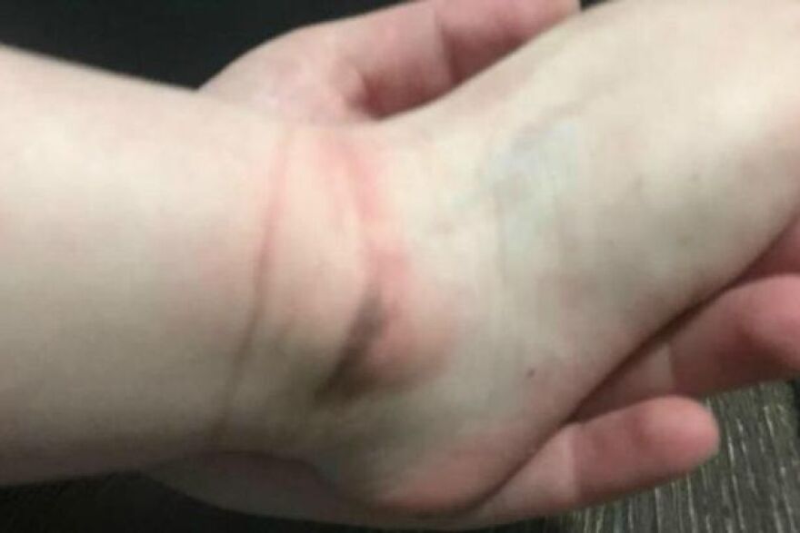 Δείτε τι έκαναν σε κοριτσάκι σε παιδικό σταθμό