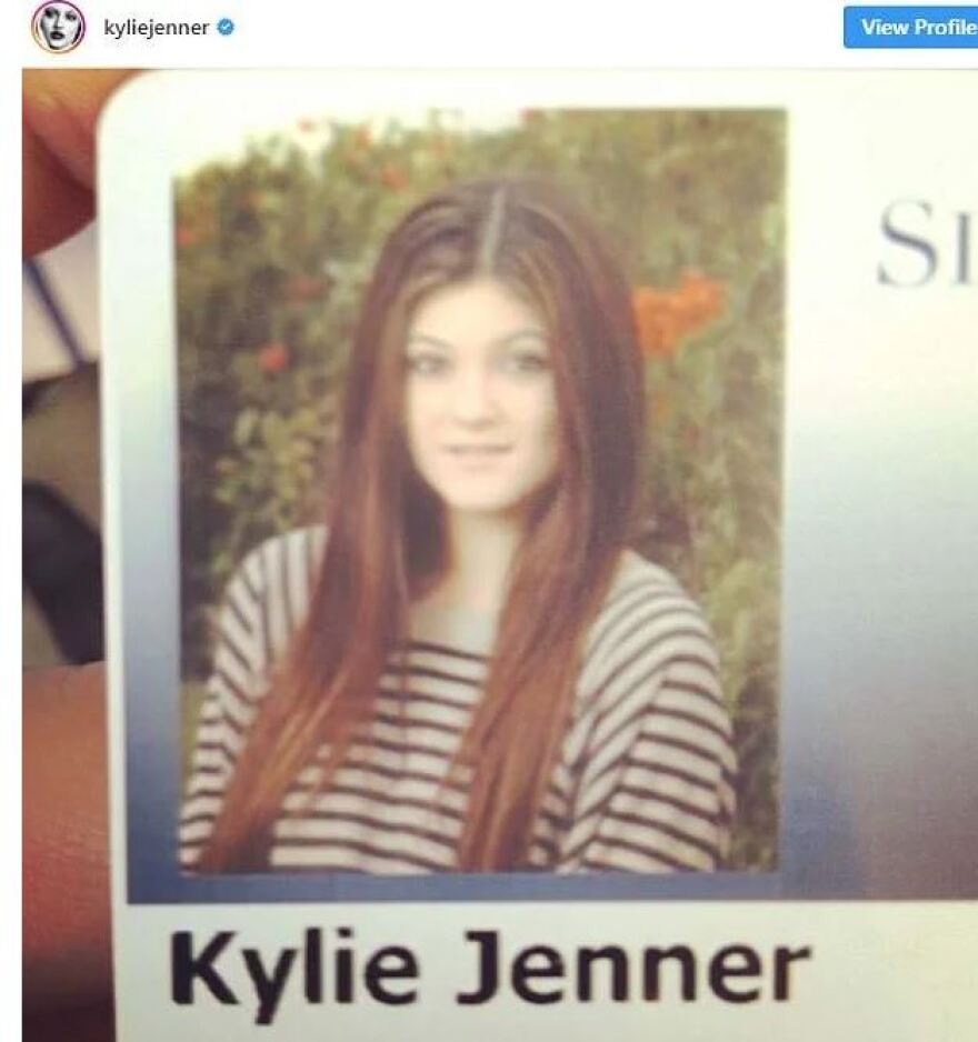 Η Kylie Jenner πριν τις πλαστικές επεμβάσεις ήταν... αγνώριστη 