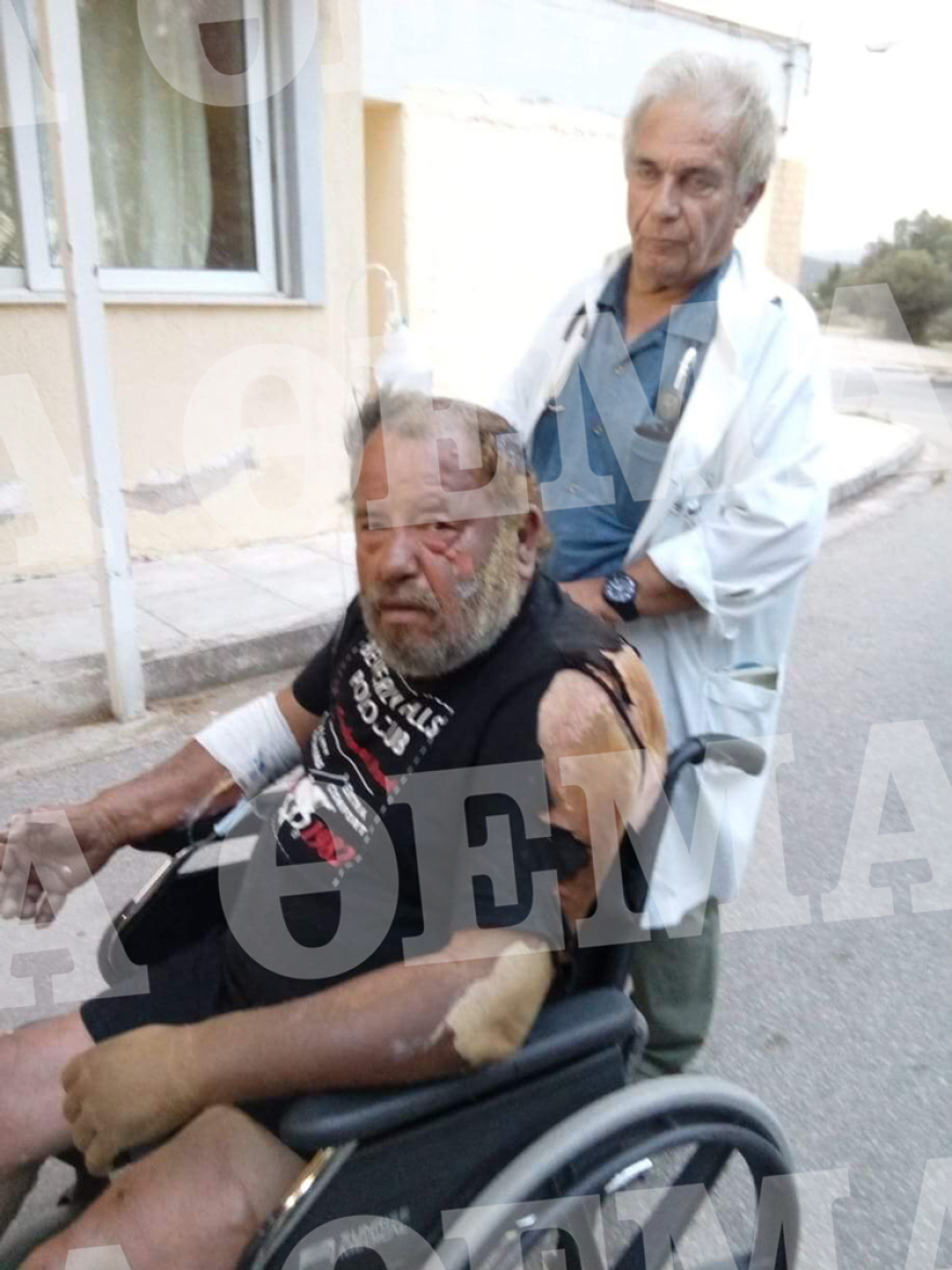 Φωτογραφίες σοκ: Τουλάχιστον 50 άτομα στα νοσοκομεία - Οι 6 διασωληνωμένοι σε ΜΕΘ