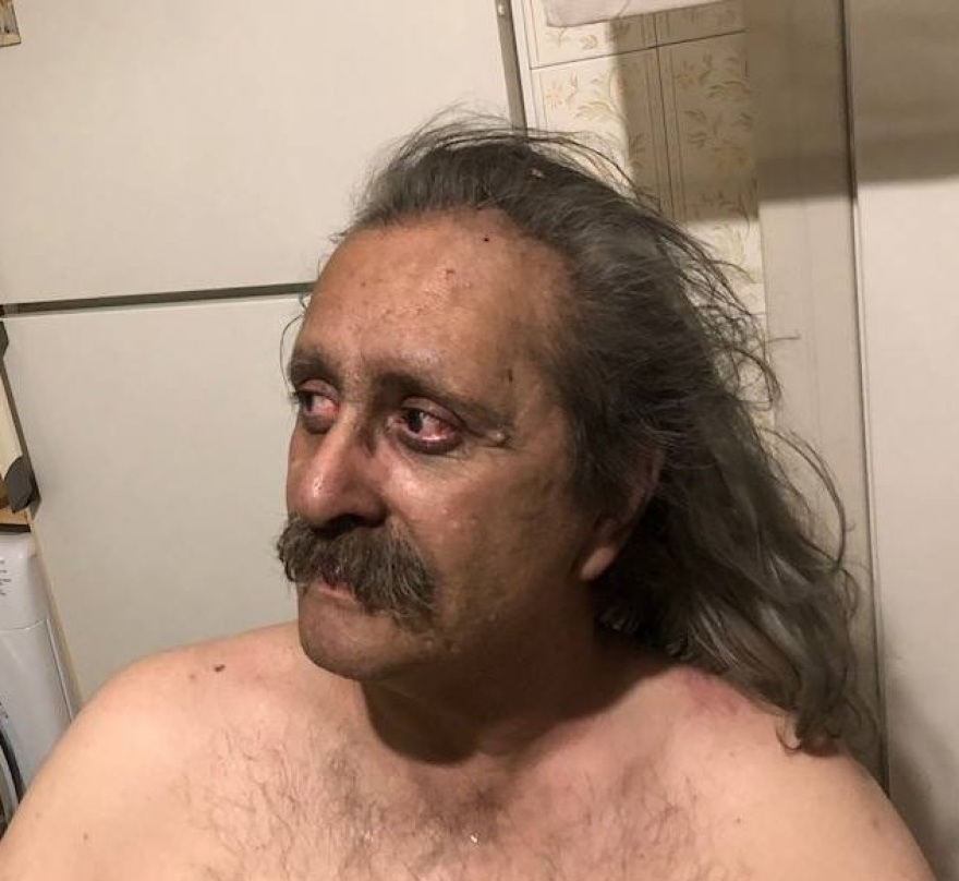 «Θέλω να δικαστούν, δεν μου φτάνει να παραιτηθούν» - Συγκλονίζει η ανάρτηση ενός τυφλού επιζήσαντα στο Μάτι