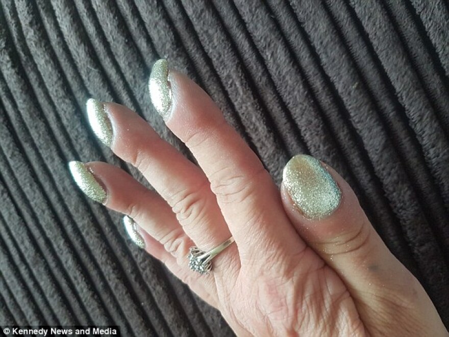 Βρετανία: Τα «άσχημα» νύχια της... «πρόδωσαν» τον καρκίνο