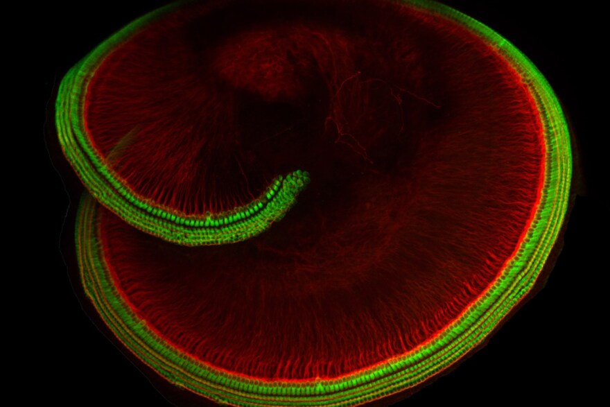 Ανοίγει ο δρόμος για τη θεραπεία της κώφωσης - Βρέθηκε η πρωτεΐνη που μας επιτρέπει να ακούμε