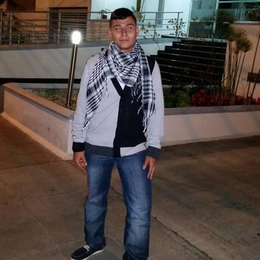 Τρομακτική μεταμόρφωση: Έκοψε τη μύτη, τα αυτιά του και τη γλώσσα του για να μοιάζει με ζωντανό σκελετό