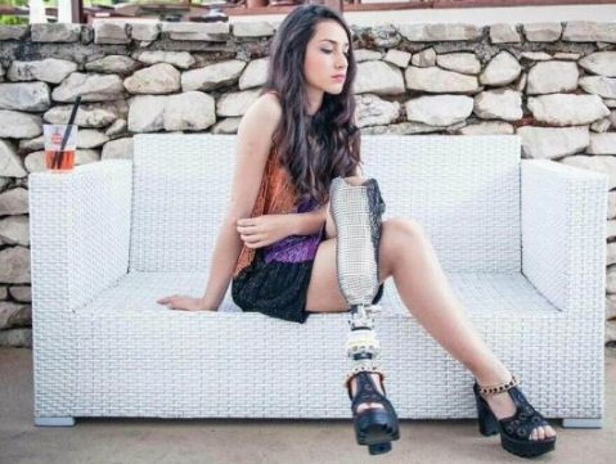 Μετά από άγριο... bullying, καλλονή με τεχνητή κνήμη βρέθηκε στην τριάδα των φιναλίστ για το «Μις Ιταλία»