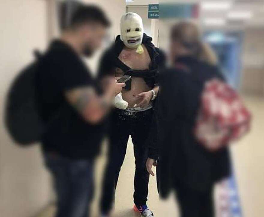 Πανικός στο εστιατόριο του Salt Bae: Θαμώνες πήραν φωτιά - Έλληνας μεταξύ των τραυματιών