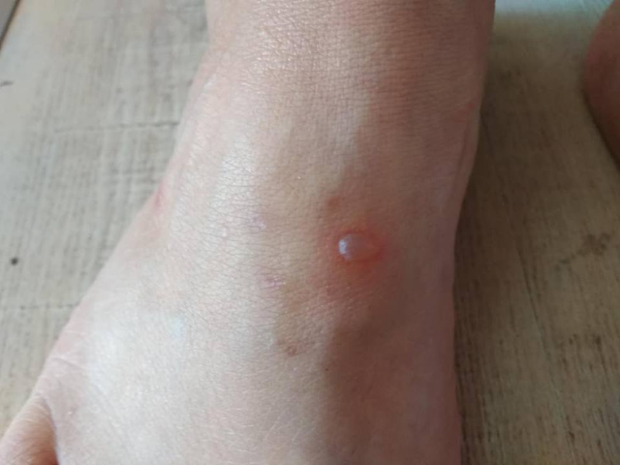  Στον ακήρυχτο πόλεμο της Λευκίμμης - Έχασε το χέρι του σε επεισόδια με την Αστυνομία 