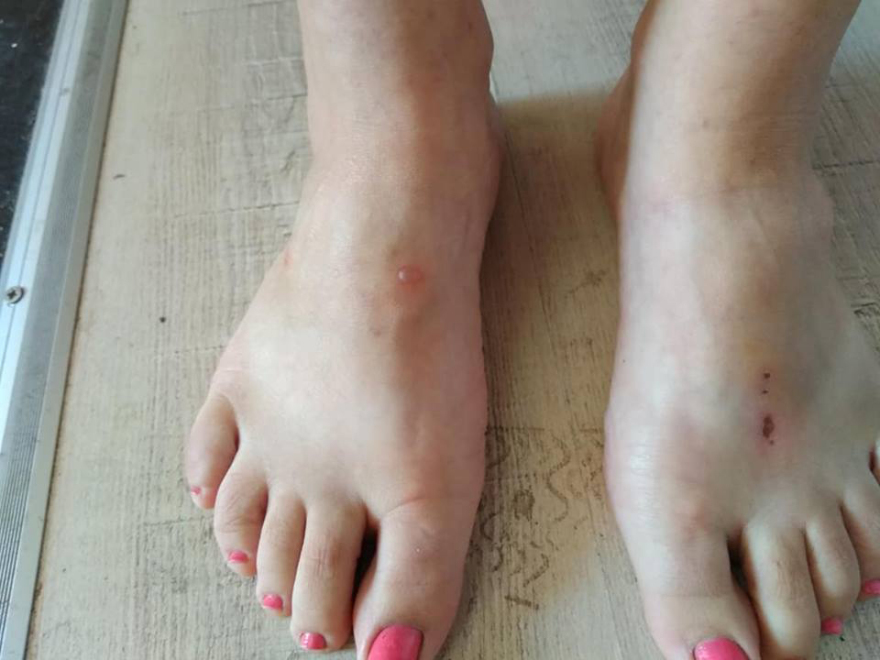  Στον ακήρυχτο πόλεμο της Λευκίμμης - Έχασε το χέρι του σε επεισόδια με την Αστυνομία 