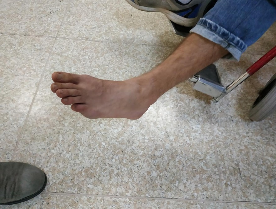 Θύελλα για την επίθεση στο Α.Τ. Ομόνοιας: Τέσσερις τραυματίες - Για «δολοφονική επίθεση» μιλούν οι αστυνομικοί