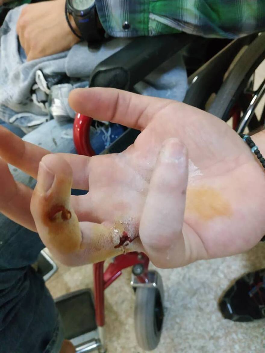 Θύελλα για την επίθεση στο Α.Τ. Ομόνοιας: Τέσσερις τραυματίες - Για «δολοφονική επίθεση» μιλούν οι αστυνομικοί