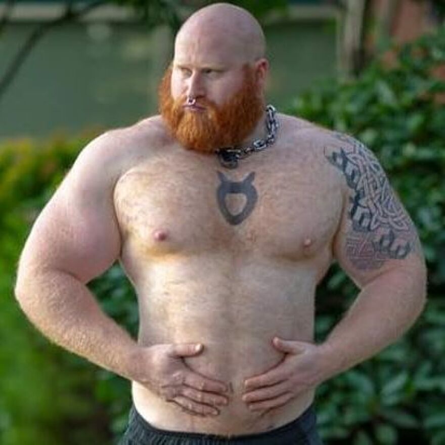 ΗΠΑ: 28χρονος πέθανε μετά από αυξητικές ενέσεις σιλικόνης στα γεννητικά του όργανα