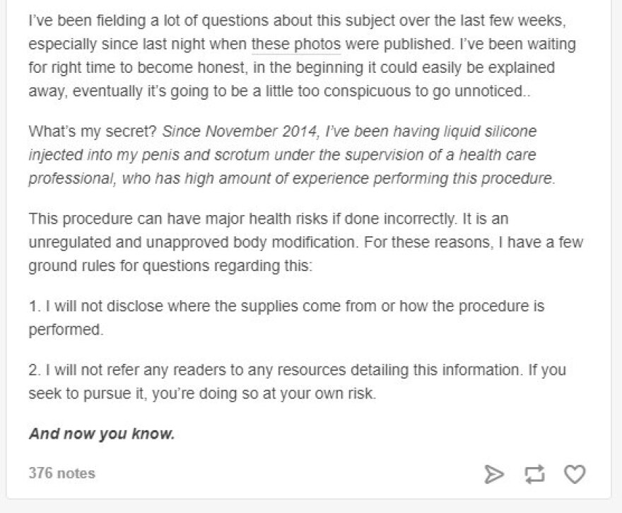 ΗΠΑ: 28χρονος πέθανε μετά από αυξητικές ενέσεις σιλικόνης στα γεννητικά του όργανα