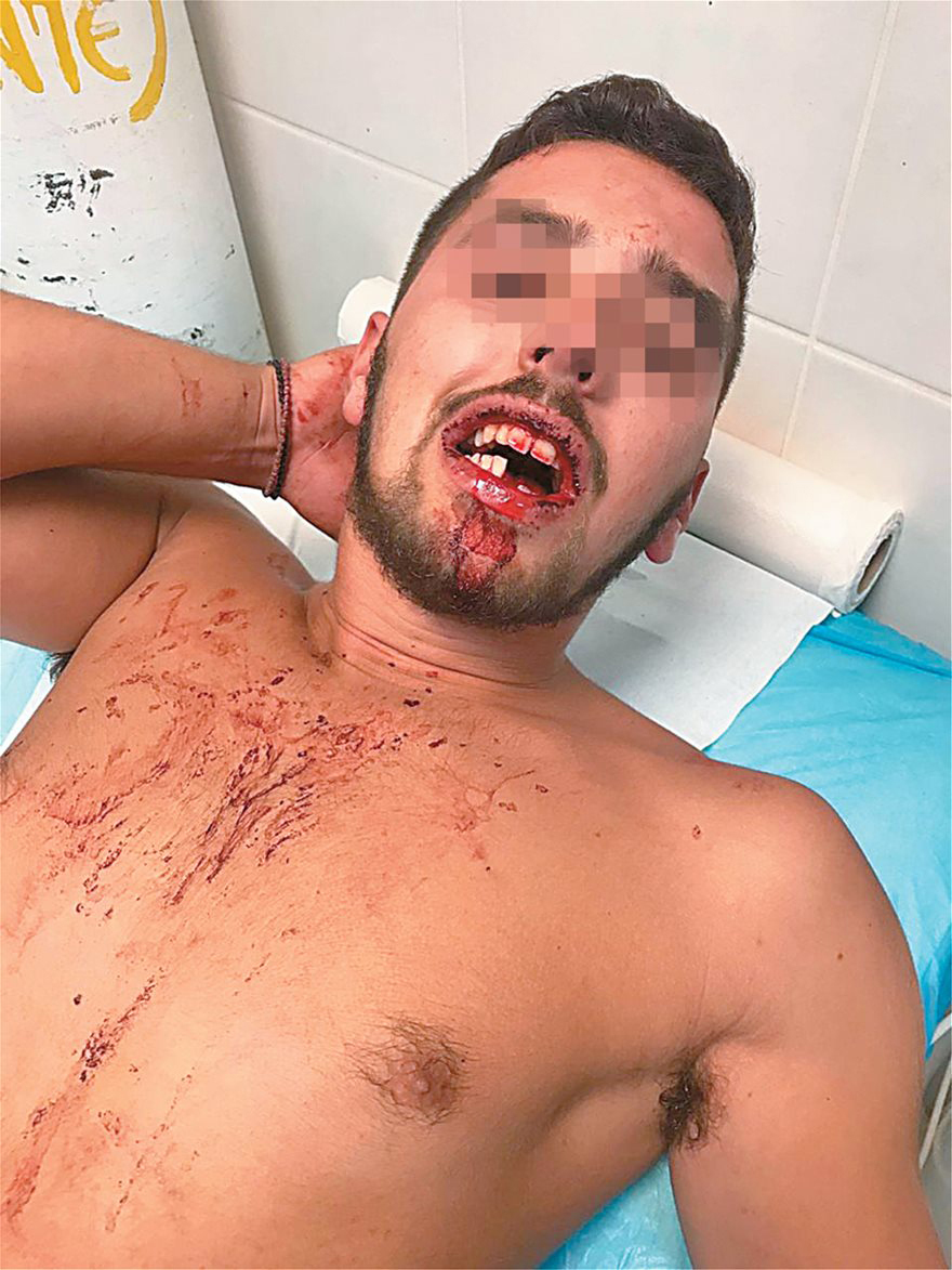 Βίντεο-ντοκουμέντο: Ο άγριος ξυλοδαρμός του 19χρονου Μυκονιάτη από τους αστυνομικούς!