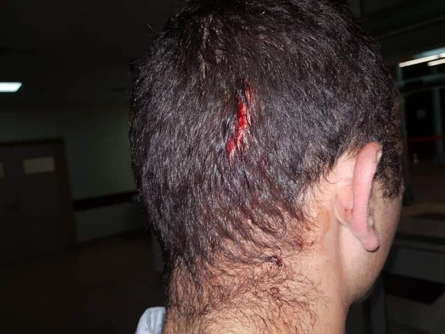 Ρομά πέταξαν μάρμαρα σε περιπολικό στου Ρέντη και άνοιξαν το κεφάλι αστυνομικού!