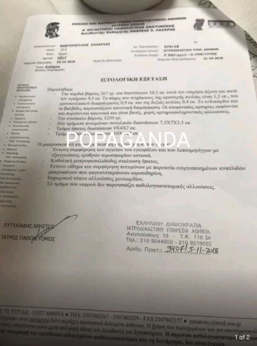 Ζακ Κωστόπουλος: «Καθαρές» οι τοξικολογικές εξετάσεις