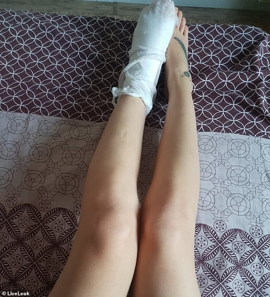 Ρωσίδα πέταξε τα ρούχα της, βούτηξε με τα εσώρουχα στην παγωμένη λίμνη και έσπασε τον αστράγαλό της