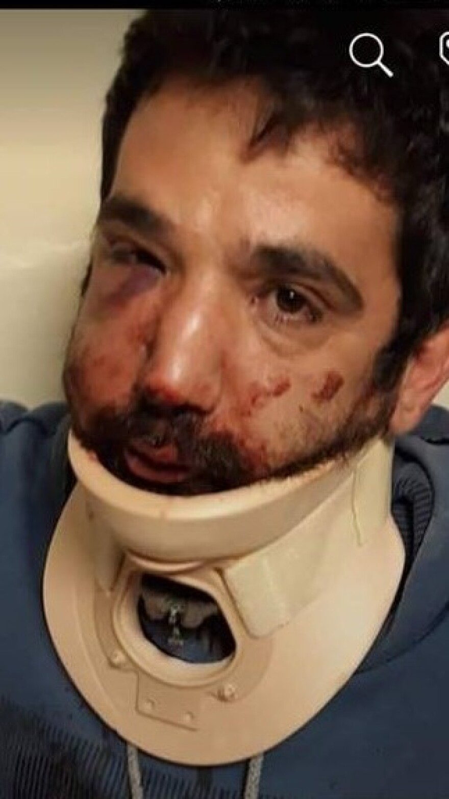 Διανομέας φαγητού καταγγέλλει ξυλοδαρμό από τον πρώην εργοδότη του