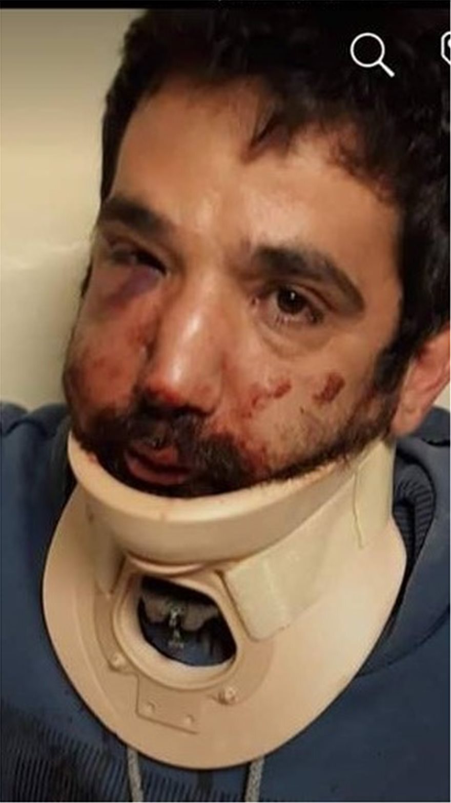 Θεσσαλονίκη: Ποινή φυλάκισης και πρόστιμο 1.000 ευρώ στον εργοδότη που ξυλοκόπησε διανομέα φαγητού