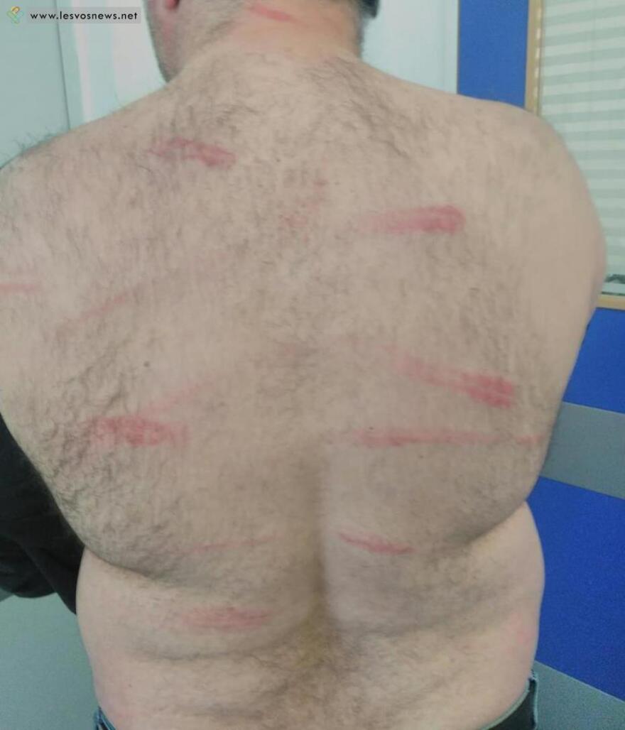 Άγριο ξύλο σε κοπή πίτας σε καφενείο της Λέσβου!