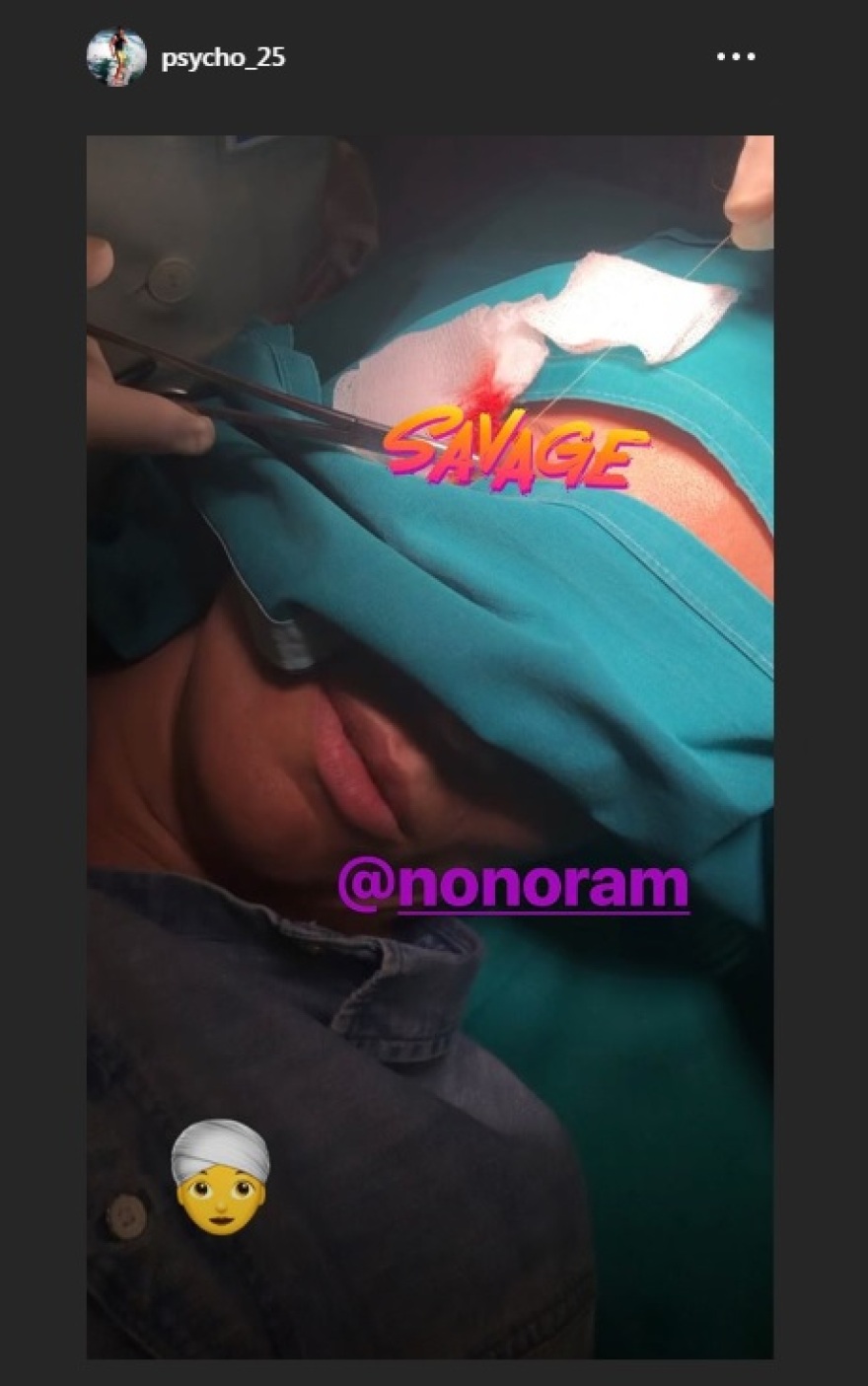 Ατύχημα για την Ελεονώρα Μελέτη - Έκανε ράμματα στο πρόσωπο