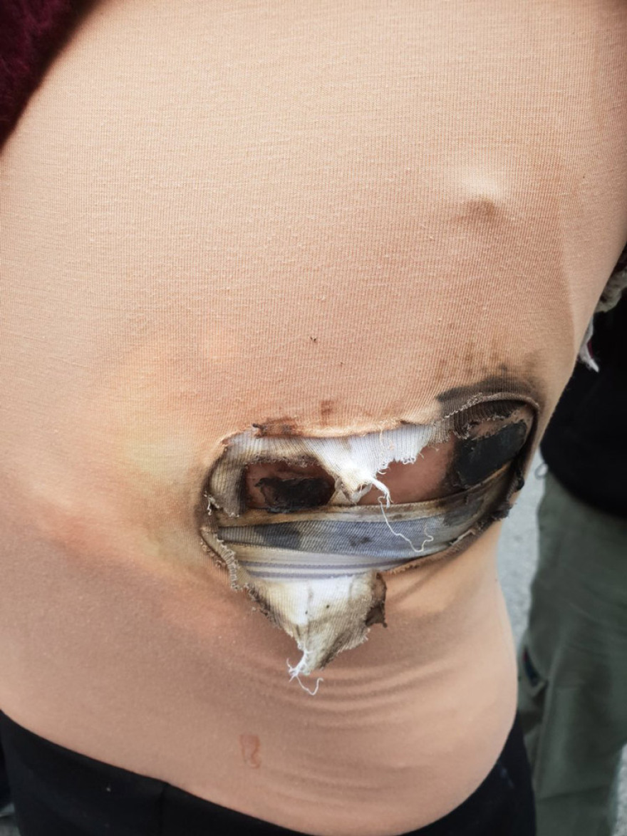 «Δεν ξέρουν πώς να μας σταματήσουν και χρησιμοποιούν βία» λέει η καθηγήτρια που τραυματίστηκε στα επεισόδια