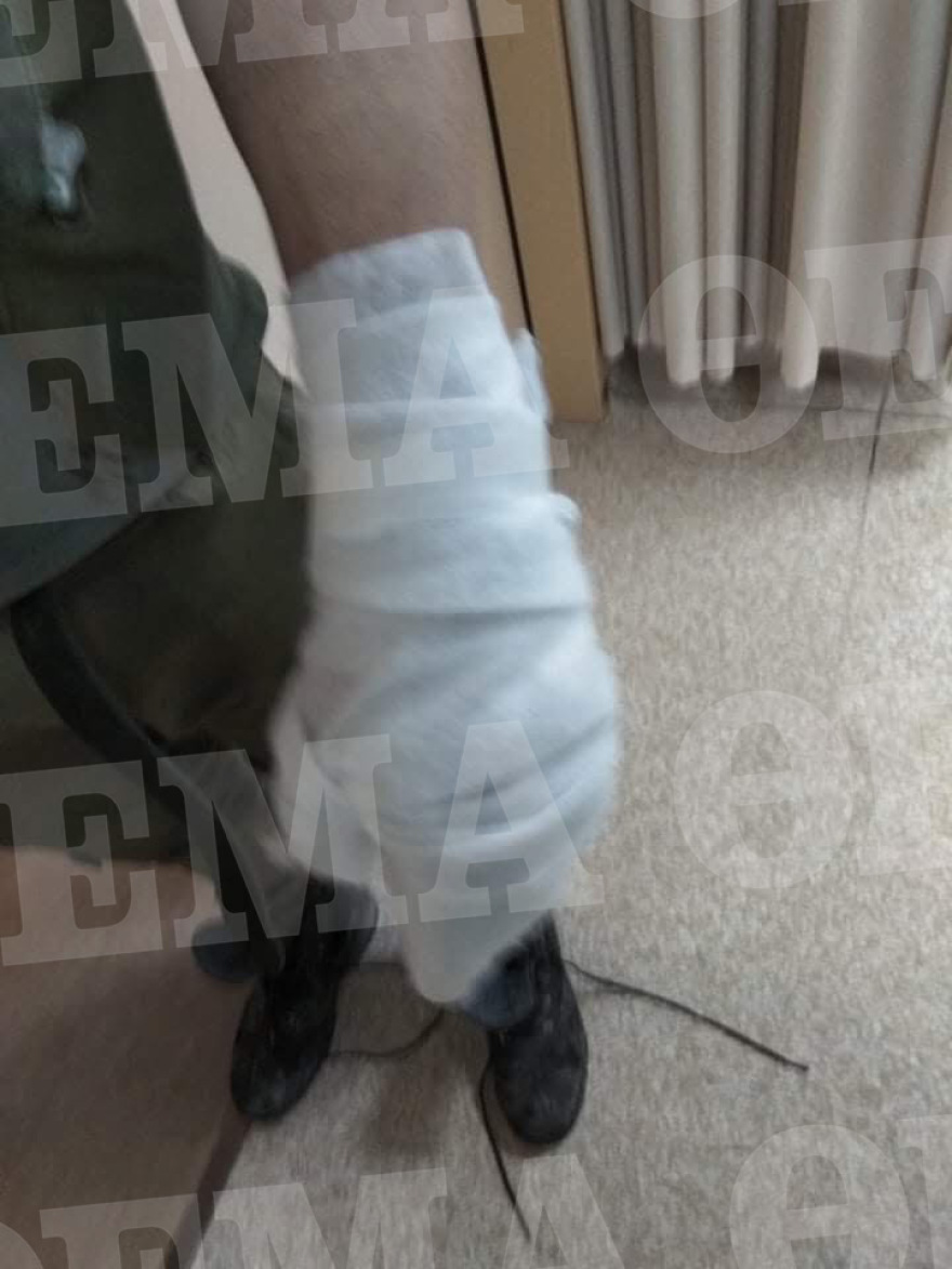 Φωτογραφίες: Τα τραύματα των αστυνομικών που μεταφέρθηκαν στο 401