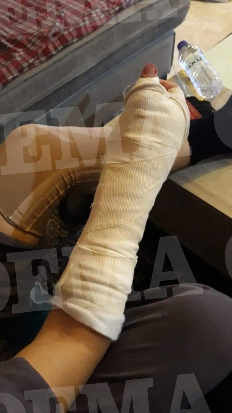 Φωτογραφίες: Τα τραύματα των αστυνομικών που μεταφέρθηκαν στο 401