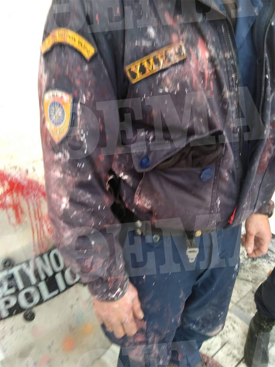 Φωτογραφίες: Τα τραύματα των αστυνομικών που μεταφέρθηκαν στο 401