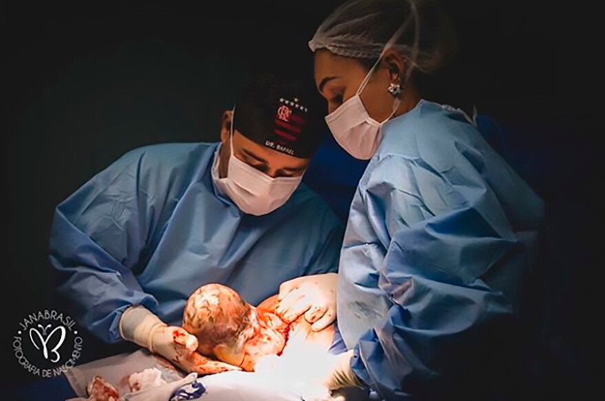 Φωτογραφίες-σοκ: Μωρό γεννήθηκε μέσα στον αμνιακό σάκο