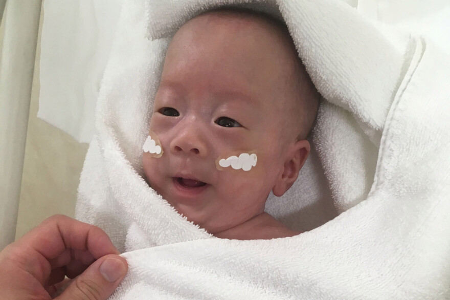 Το μικρότερο νεογέννητο στον κόσμο: Γεννήθηκε 268 γραμμάρια - Εγινε πέντε μηνών και 3,2 κιλά!