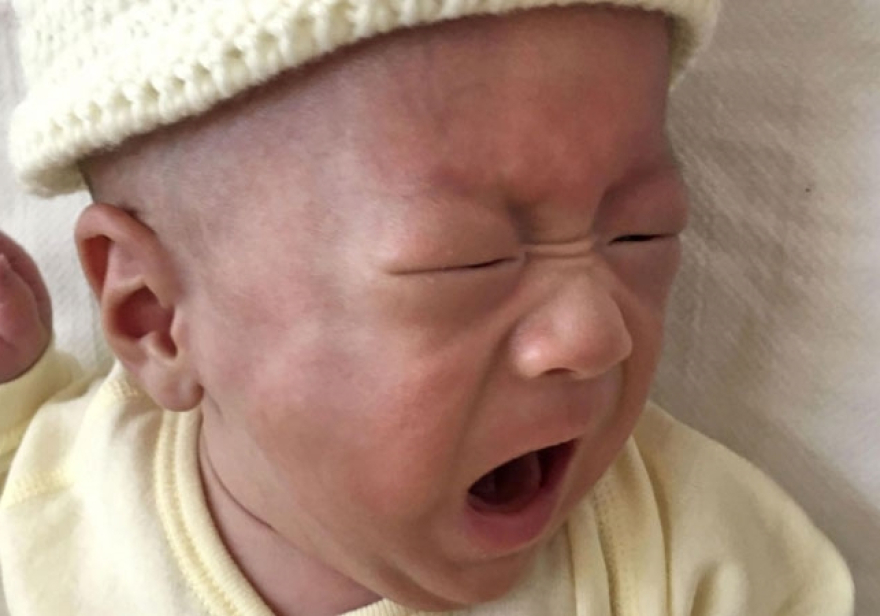 Το μικρότερο νεογέννητο στον κόσμο: Γεννήθηκε 268 γραμμάρια - Εγινε πέντε μηνών και 3,2 κιλά!