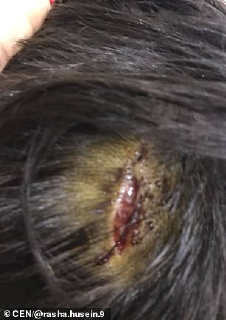 Γυναίκα έσωσε με αυτοθυσία μικρό αγόρι που δέχθηκε άγρια επίθεση από σκυλιά