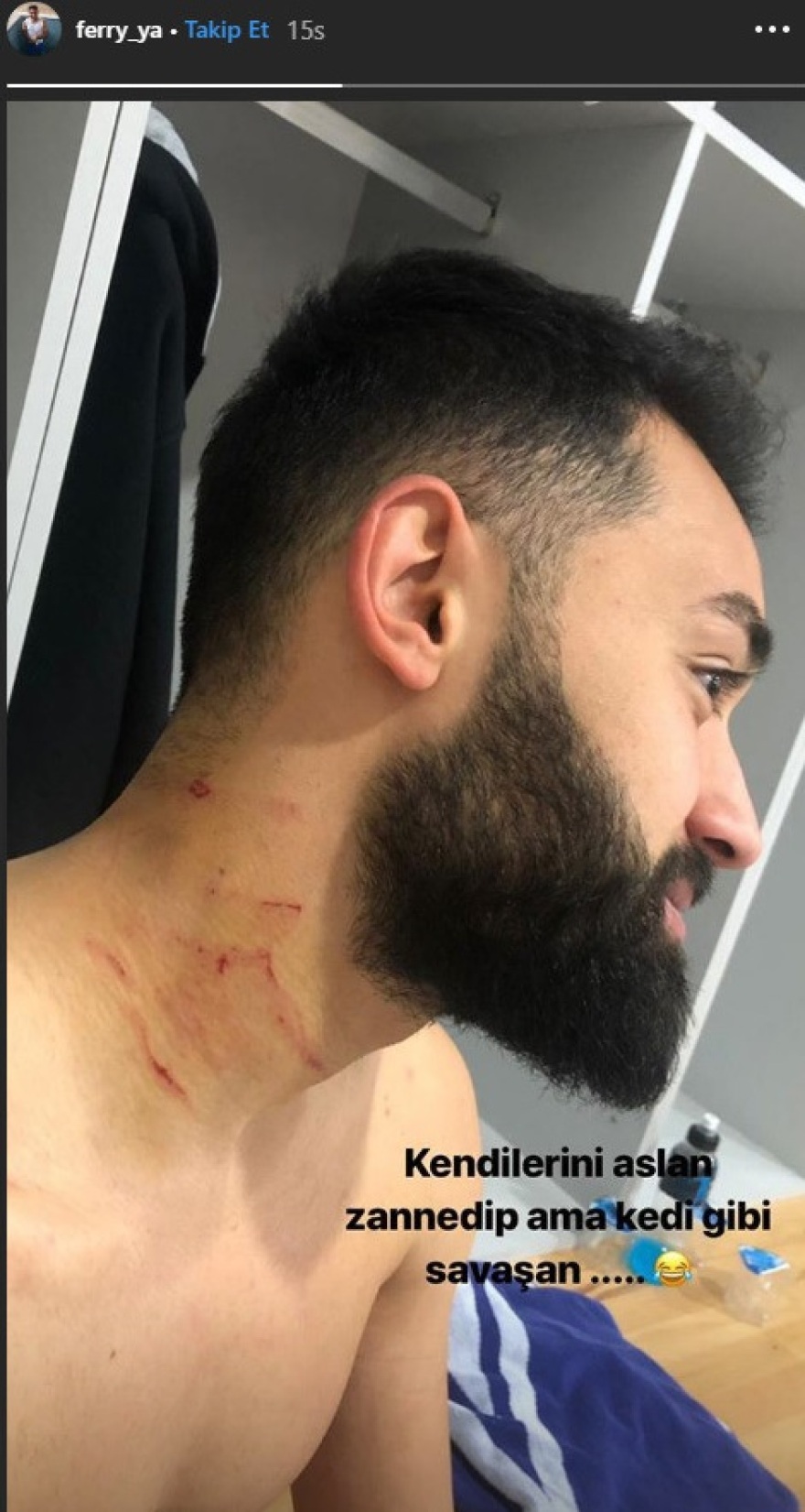 Τούρκος ποδοσφαιριστής τραυμάτισε αντίπαλο με λεπίδα που είχε μαζί του στο γήπεδο