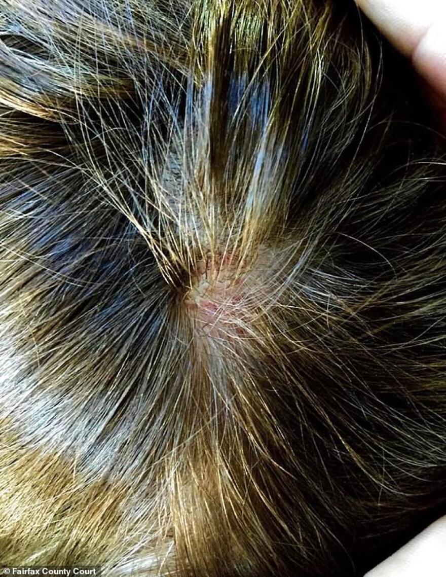 Η Αμπερ Χερντ «τελειώνει» τον Τζόνι Ντεπ: Μου ξερίζωσε τα μαλλιά χτυπώντας με αλύπητα 