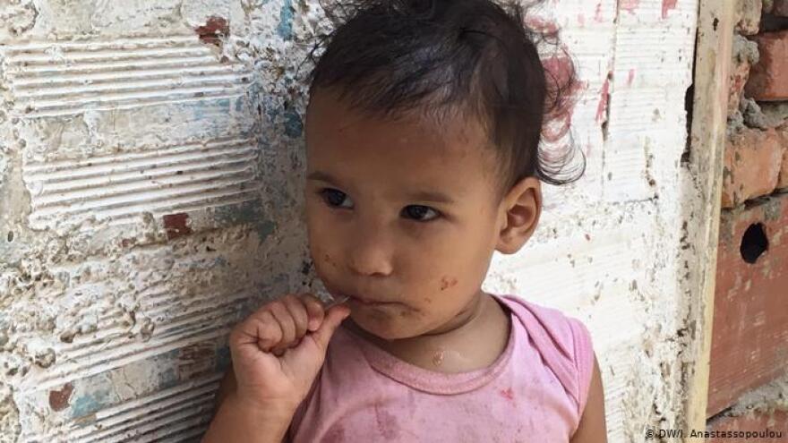 Οδοιπορικό της Deutche Welle στα νοσοκομεία της Βενεζουέλας: Ελλείψεις, τρύπια στρώματα, μαυρισμένες τουαλέτες!